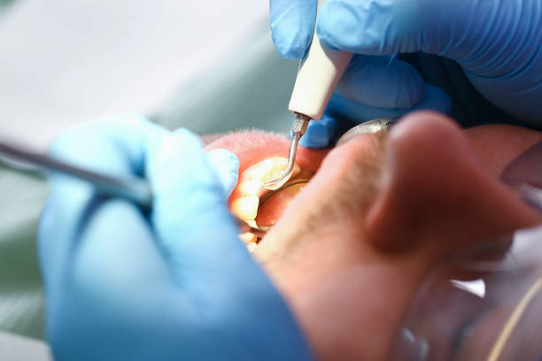 Best Urgent Care for Lost Fillings or Crowns in Spring City, PA