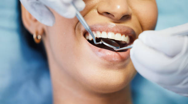 Best Emergency Dental Care for Broken or Chipped Teeth in Spring City, PA